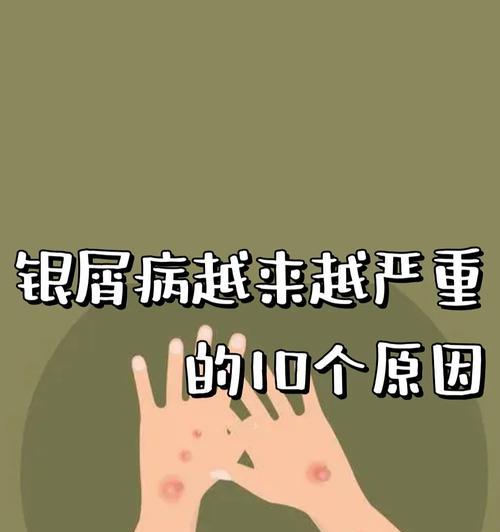 绿豆黄叶病——病因及治疗方法（由何而来？如何治疗？）